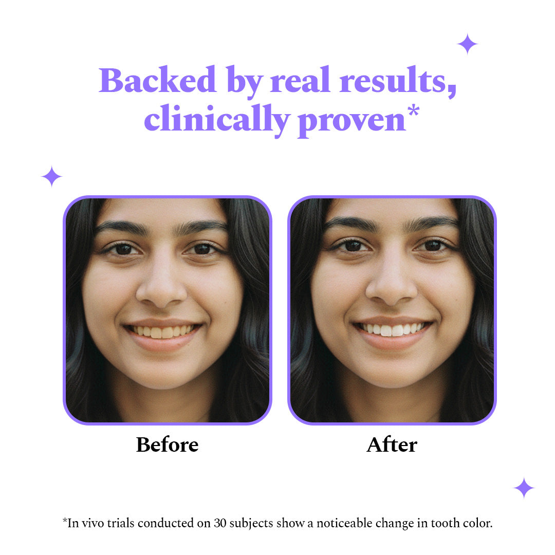 HandyCozy Purple Teeth Whitening Strips – Peroxide-Free, Enamel-Safe Instant Brightening (7 Strips Pack)