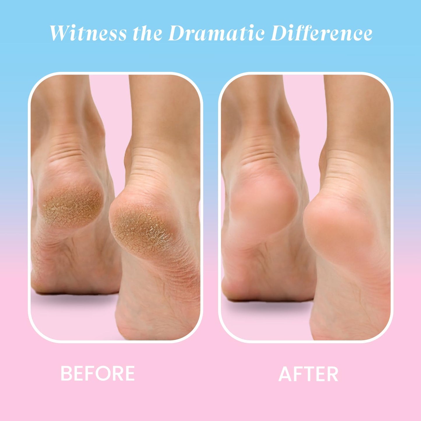 HandyCozy Electric Foot Callus Remover – Rechargeable Pedicure Foot File with Dual Speed & Roller Heads